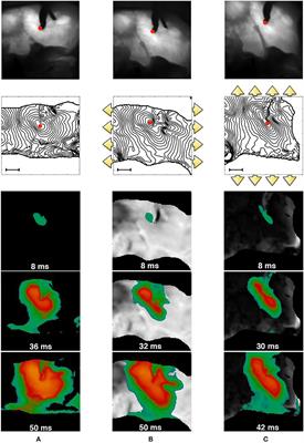 Competing Mechanisms of Stress-Assisted Diffusivity and Stretch-Activated Currents in Cardiac Electromechanics